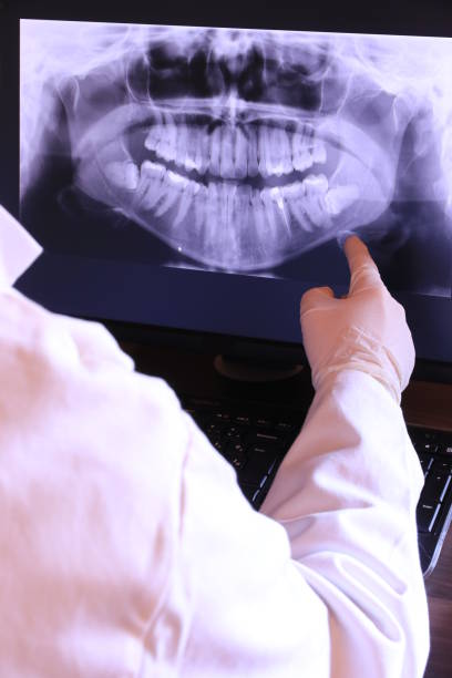 Best Emergency Root Canal Treatment in Frankfort, IN