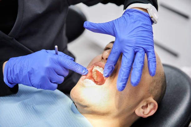 Best Emergency Denture Repair in Frankfort, IN
